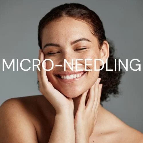 Micro-Needling Emerge Aesthetics Med Spa