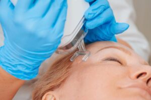 CO₂ Laser Resurfacing in Glen Rock New Jersey