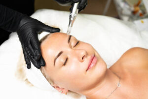 The truth about DIY Microneedling