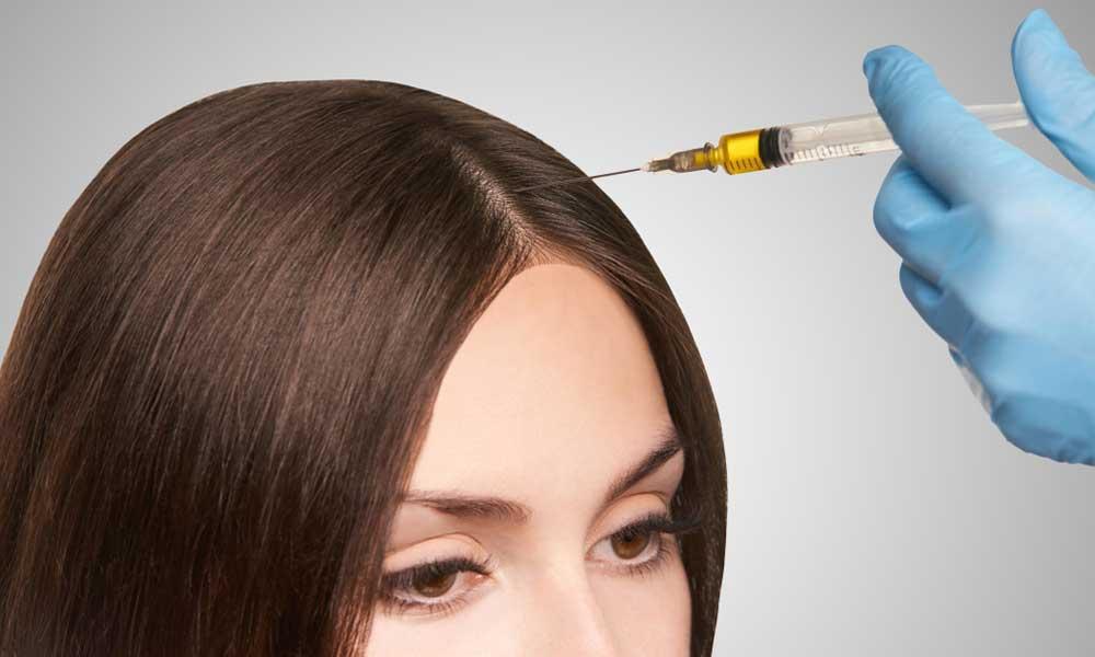 Hair Restoration with PRP Injections