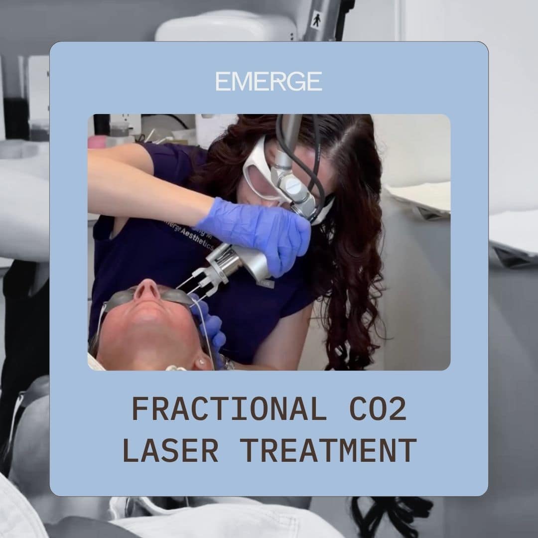 What Is Fractional Laser CO2 Treatment