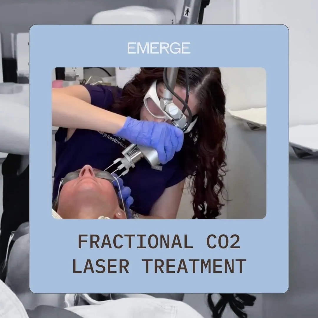 What Is Fractional Laser CO2 Treatment What Is Fractional Laser CO2 Treatment