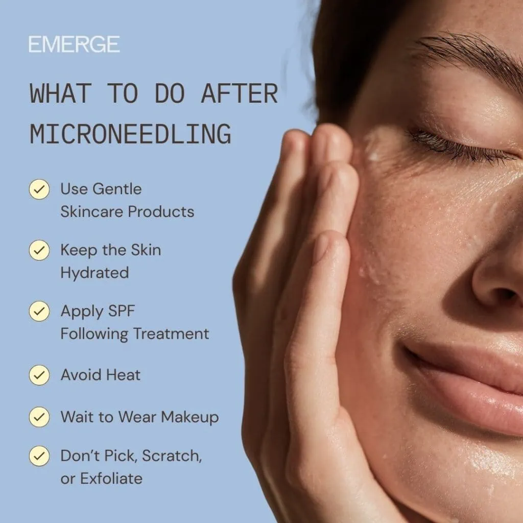 What to Do After Microneedling Treatment List of What to Do After Microneedling Treatment