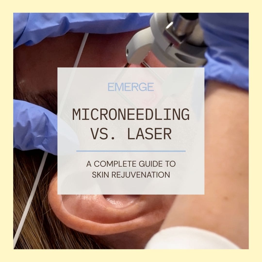 Microneedling vs. Laser: A Complete Guide to Skin Rejuvenation