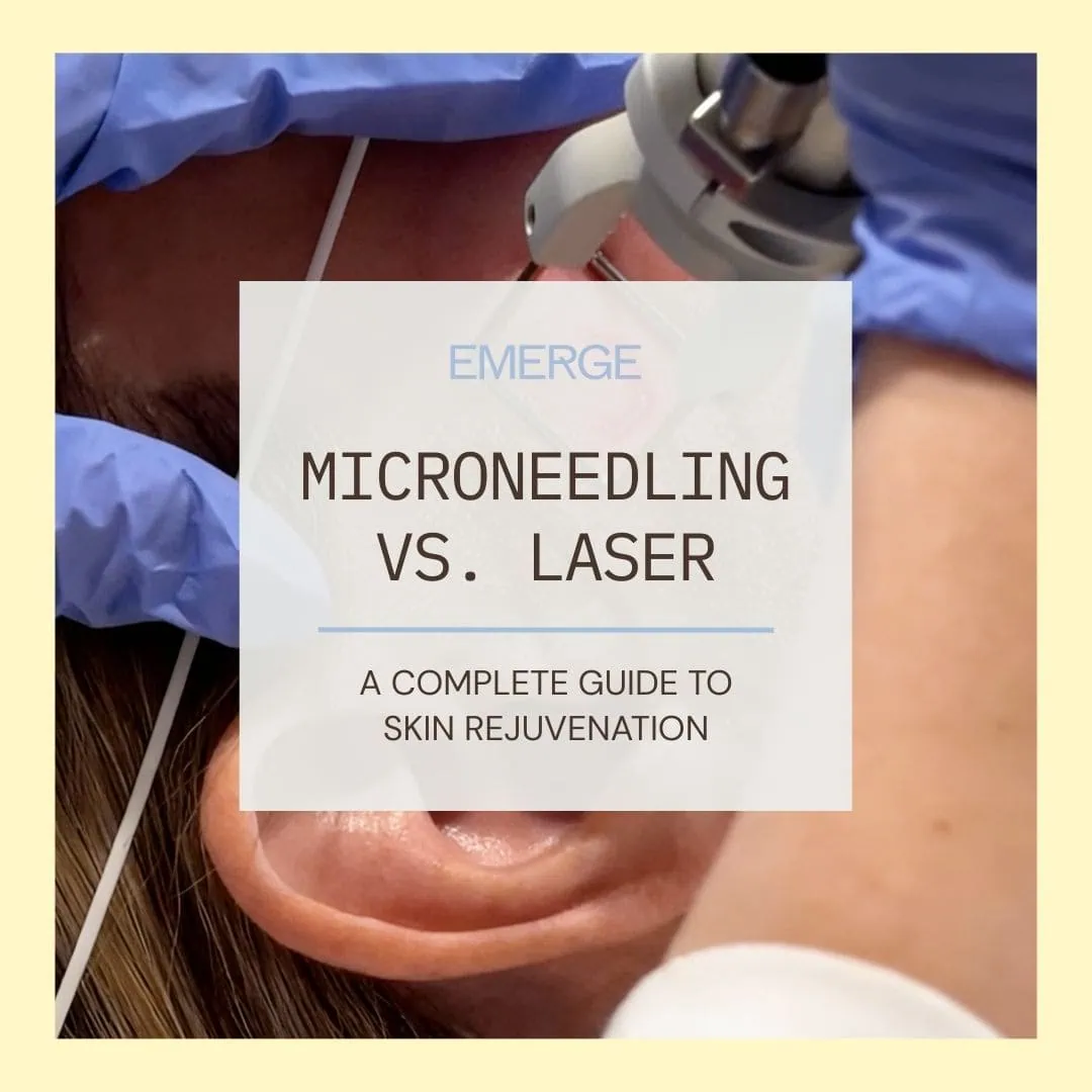 2 | Emerge Aesthetics by Dr. Rochelle Kling MD Microneedling vs. Laser