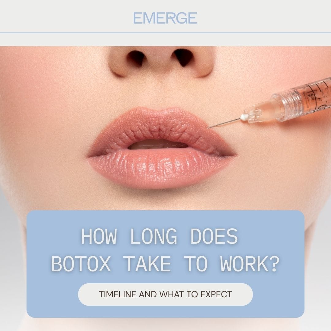 How Long Does Botox Take to Work? Timeline and What to Expect