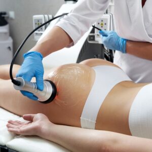 How Does Body Contouring Work
