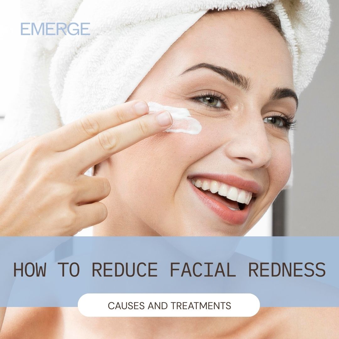 How to Reduce Facial Redness: Causes and Treatments