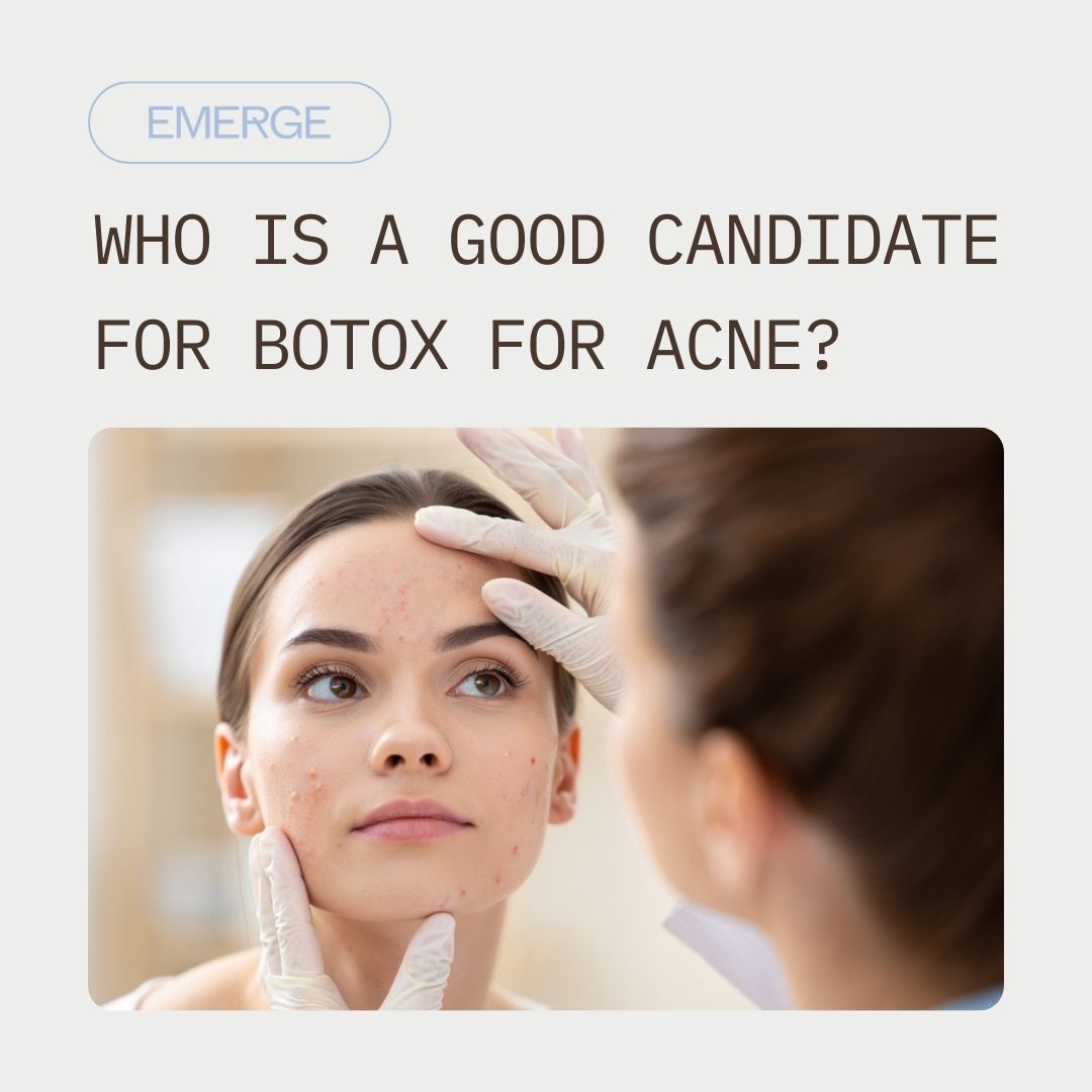 Who Is a Good Candidate for Botox for Acne
