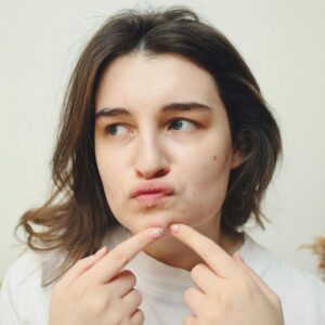 Does Botox Help Acne