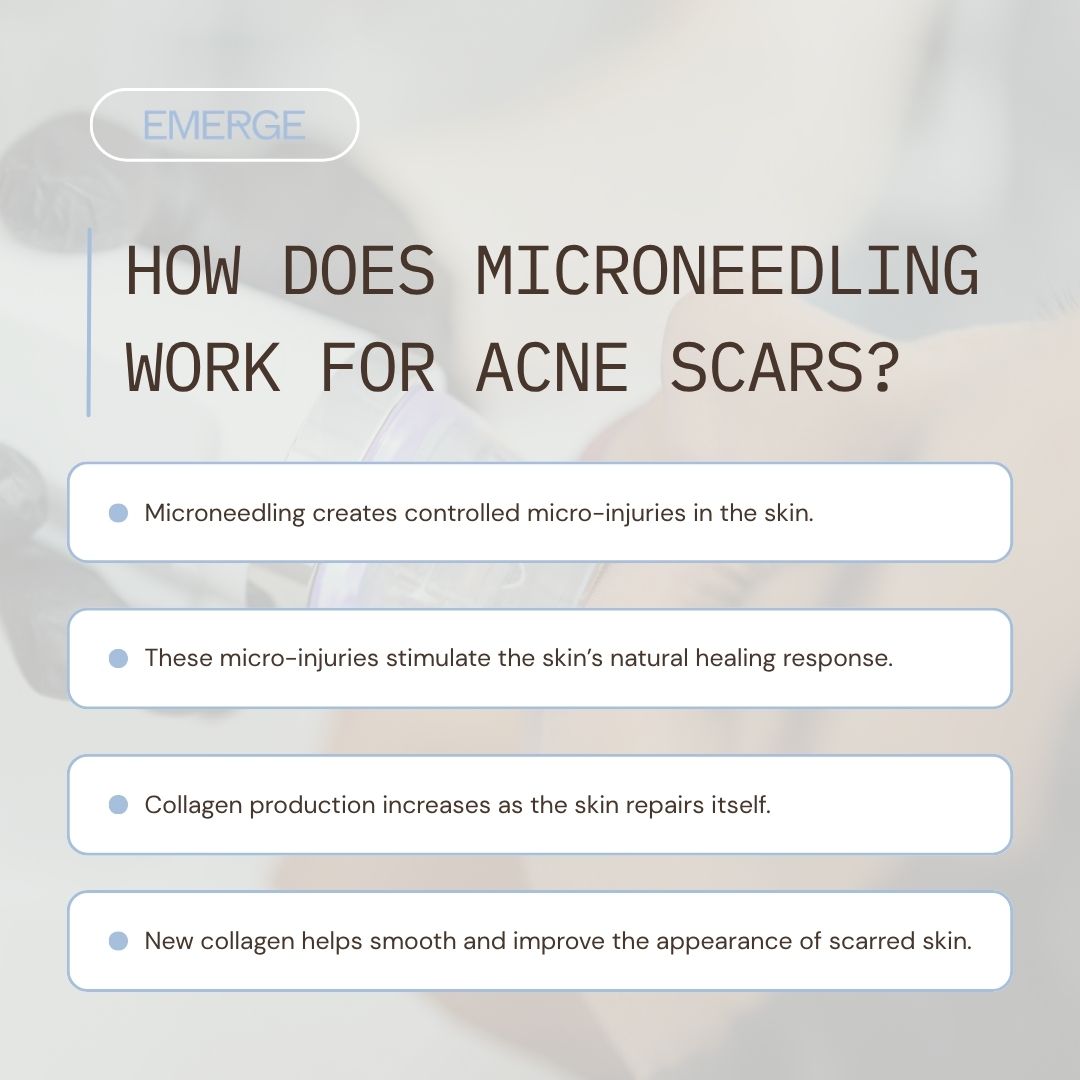 how does microneedling work for acne scars?