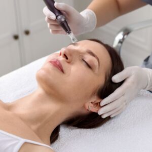 how many microneedling sessions for acne scars?