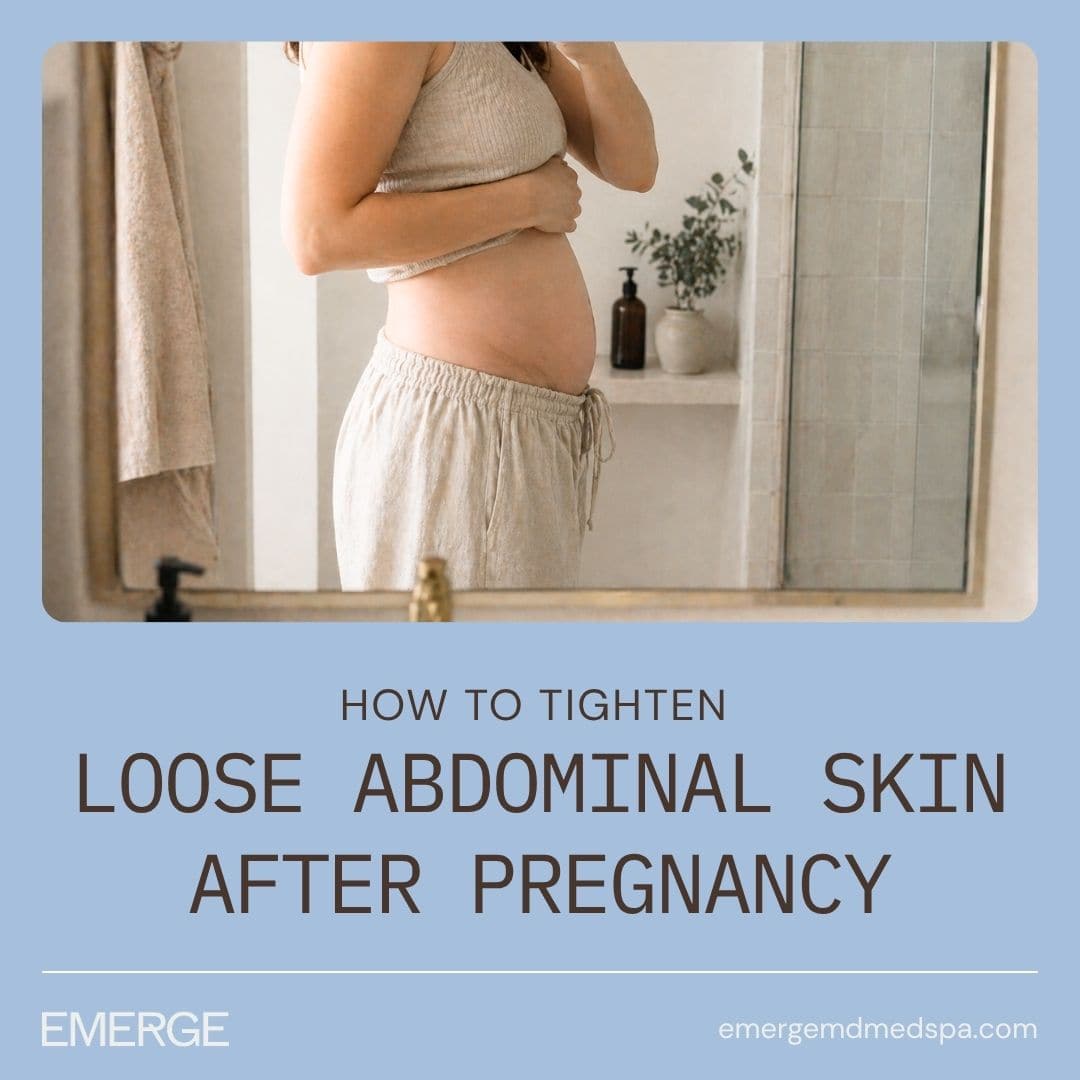 How to Tighten Loose Abdominal Skin After Pregnancy