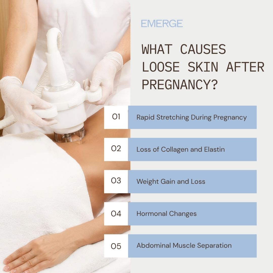 What Causes Loose Skin After Pregnancy