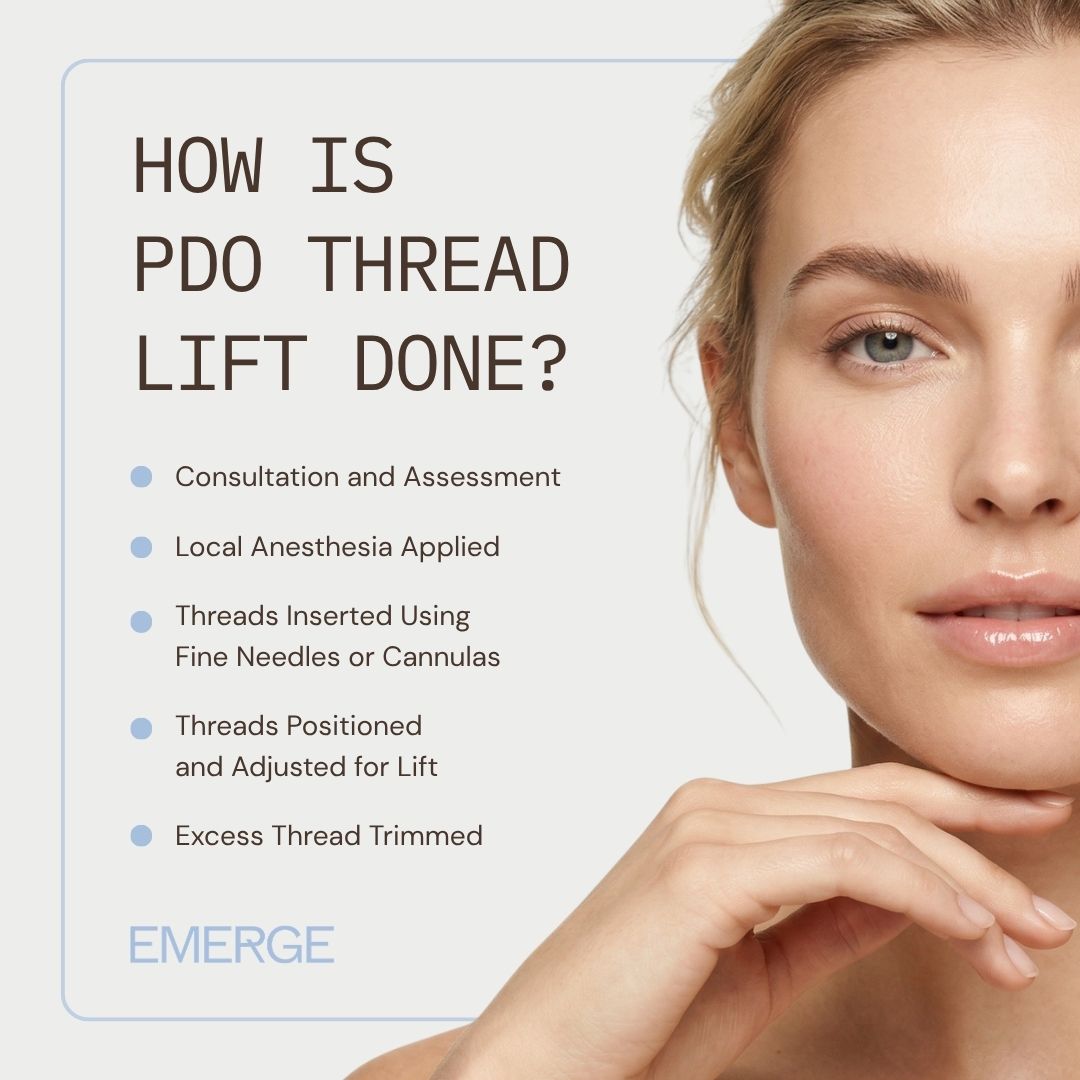 How Is PDO Thread Lift Done
