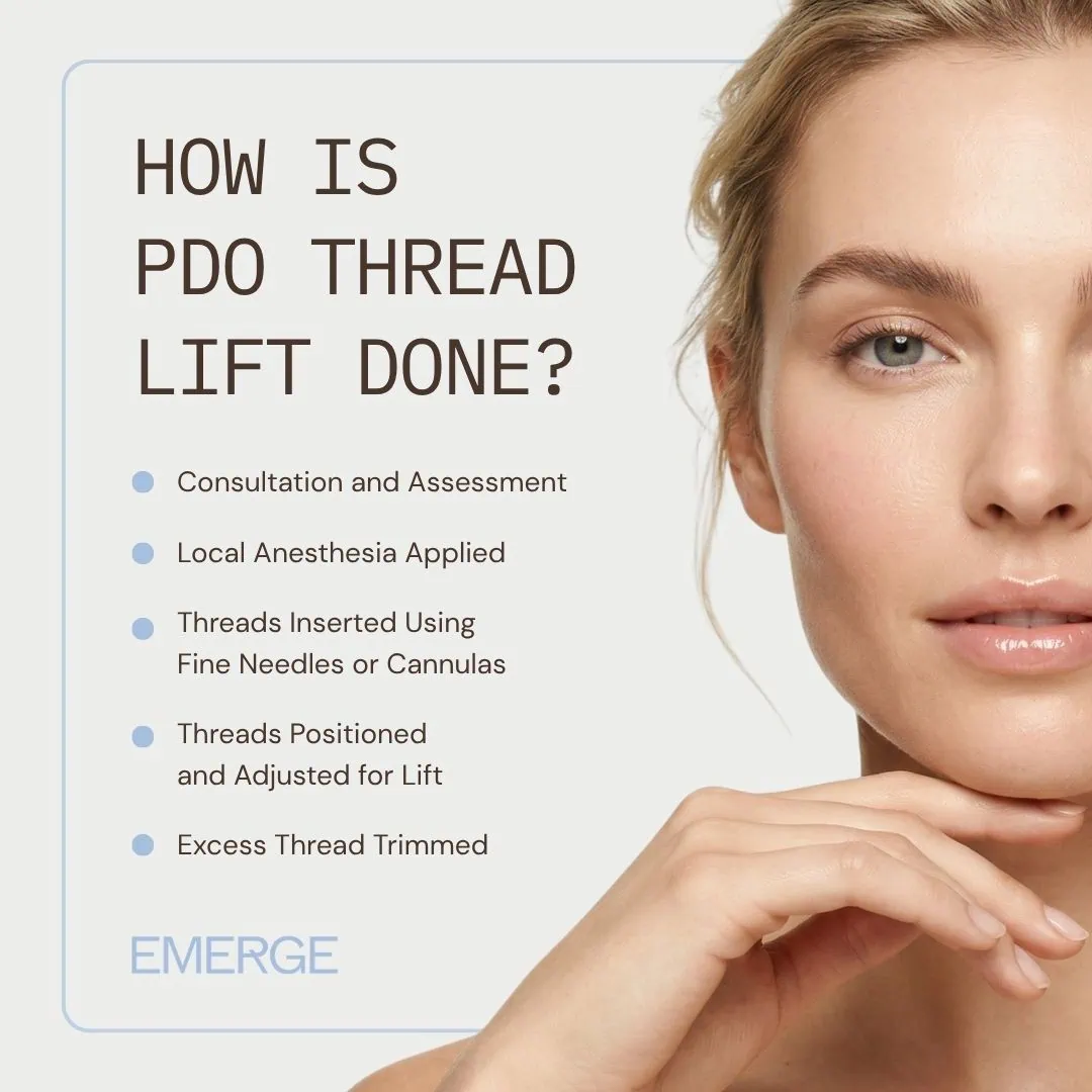 4 | Emerge Aesthetics by Dr. Rochelle Kling MD How Is PDO Thread Lift Done