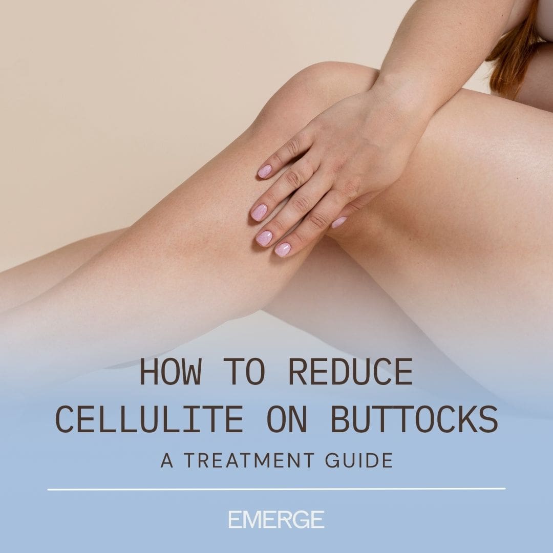 How to Reduce Cellulite on Buttocks