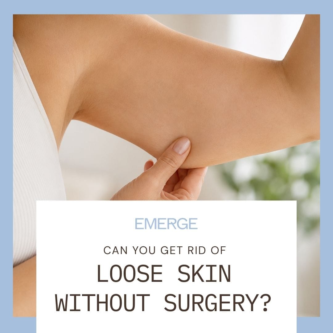 Can You Get Rid of Loose Skin Without Surgery | Emerge Aesthetics by Dr. Rochelle Kling MD Can You Get Rid of Loose Skin Without Surgery