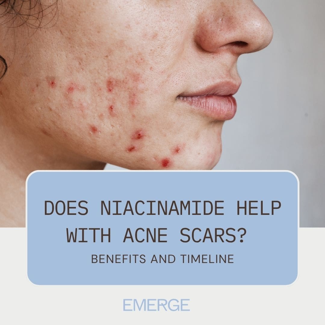 Does Niacinamide Help with Acne Scars