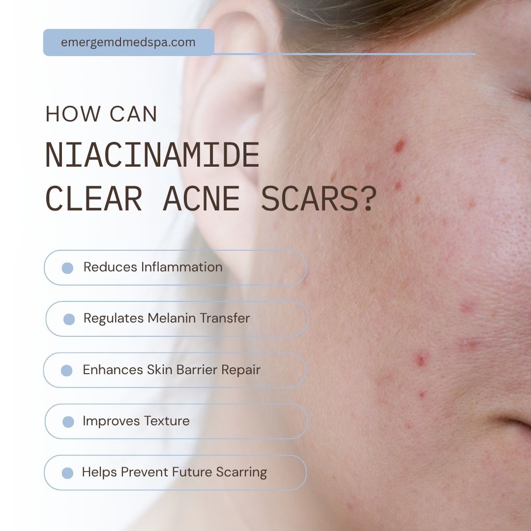 How Can Niacinamide Clear Acne Scars