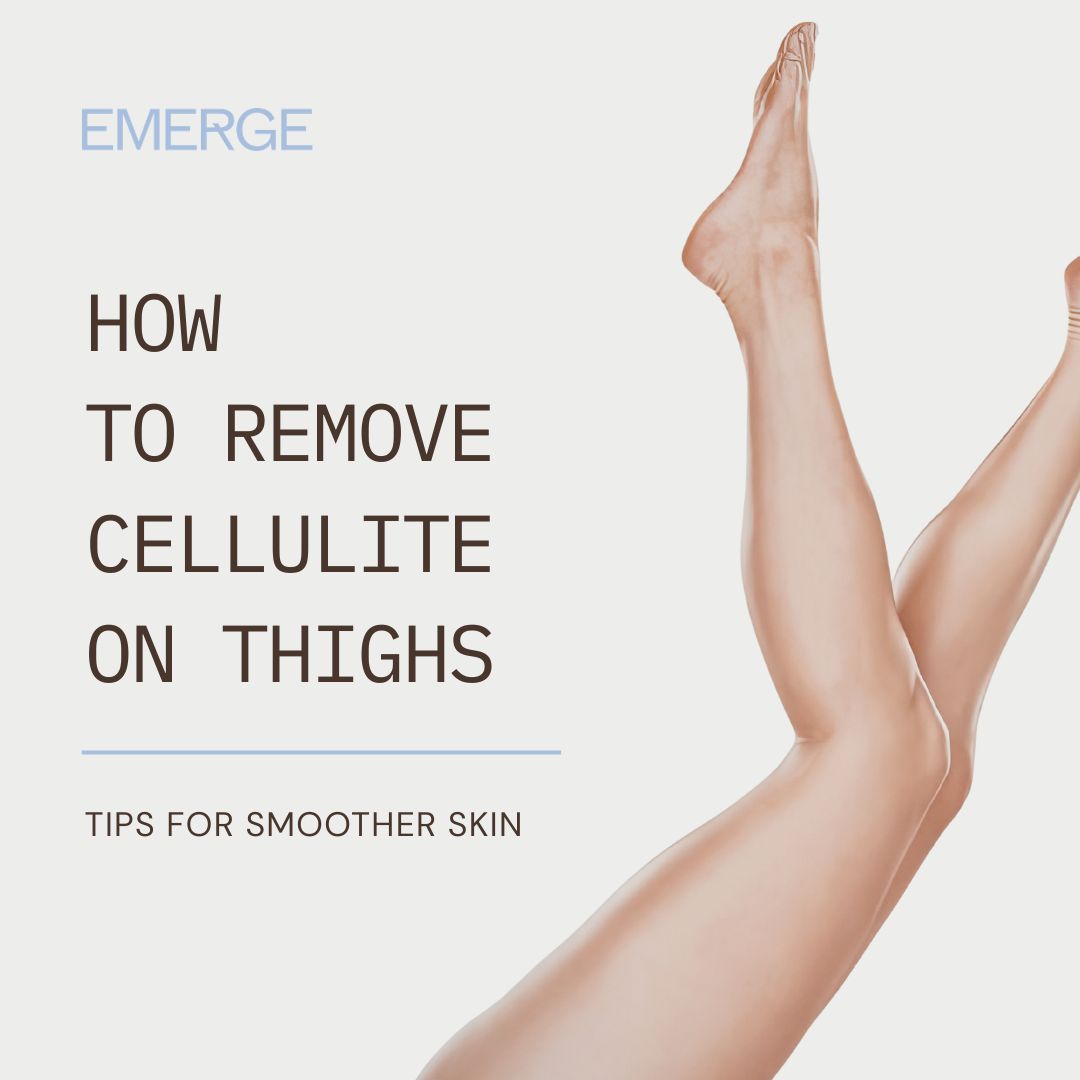 How to Remove Cellulite on Thighs_ Tips for Smoother Skin