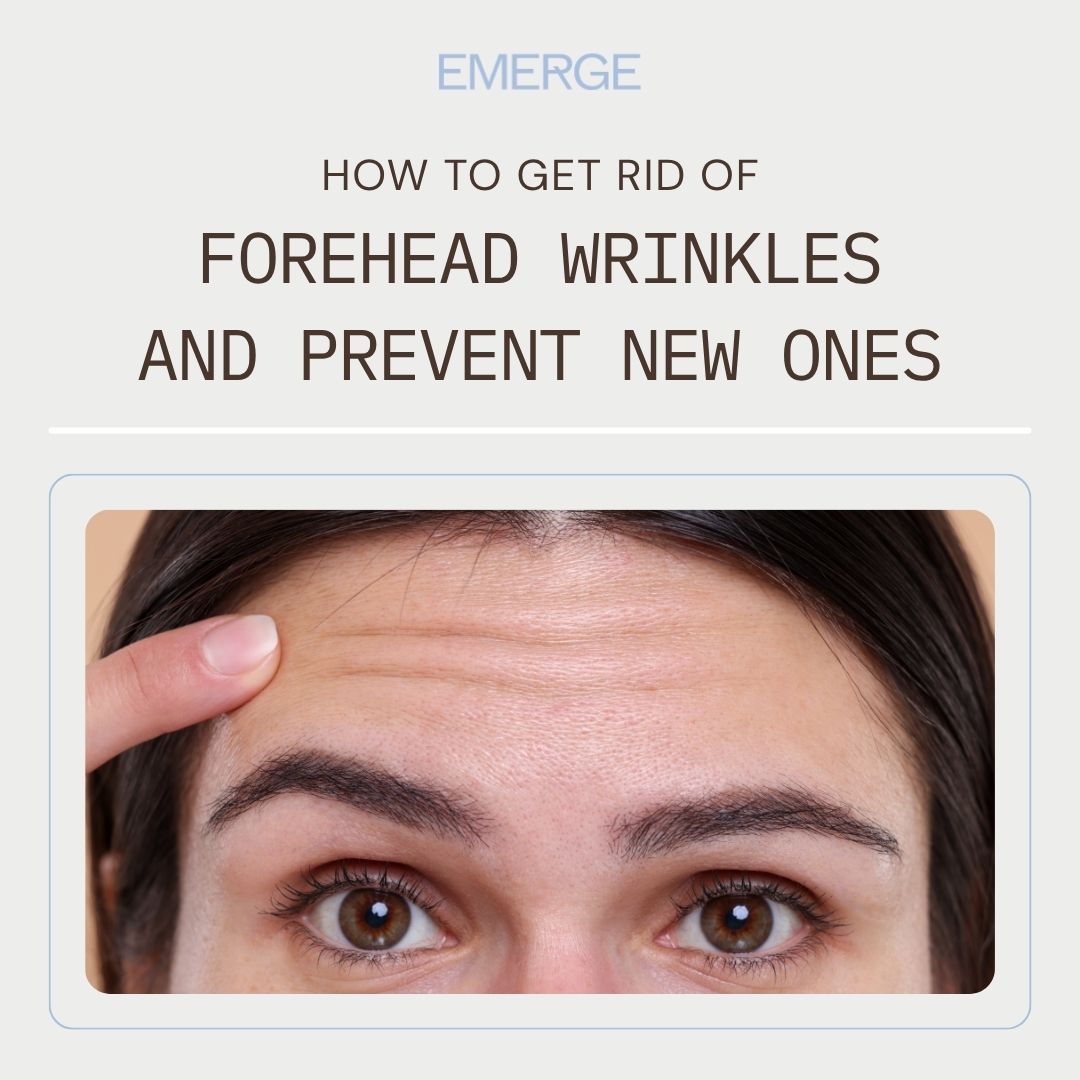 How to Get Rid of Forehead Wrinkles and Prevent New Ones | Emerge Aesthetics by Dr. Rochelle Kling MD How to Get Rid of Forehead Wrinkles and Prevent New Ones