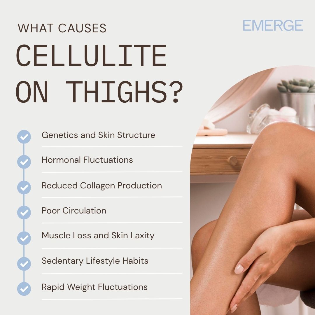 What Causes Cellulite on Thighs