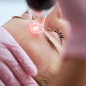 Does Laser Treatment
