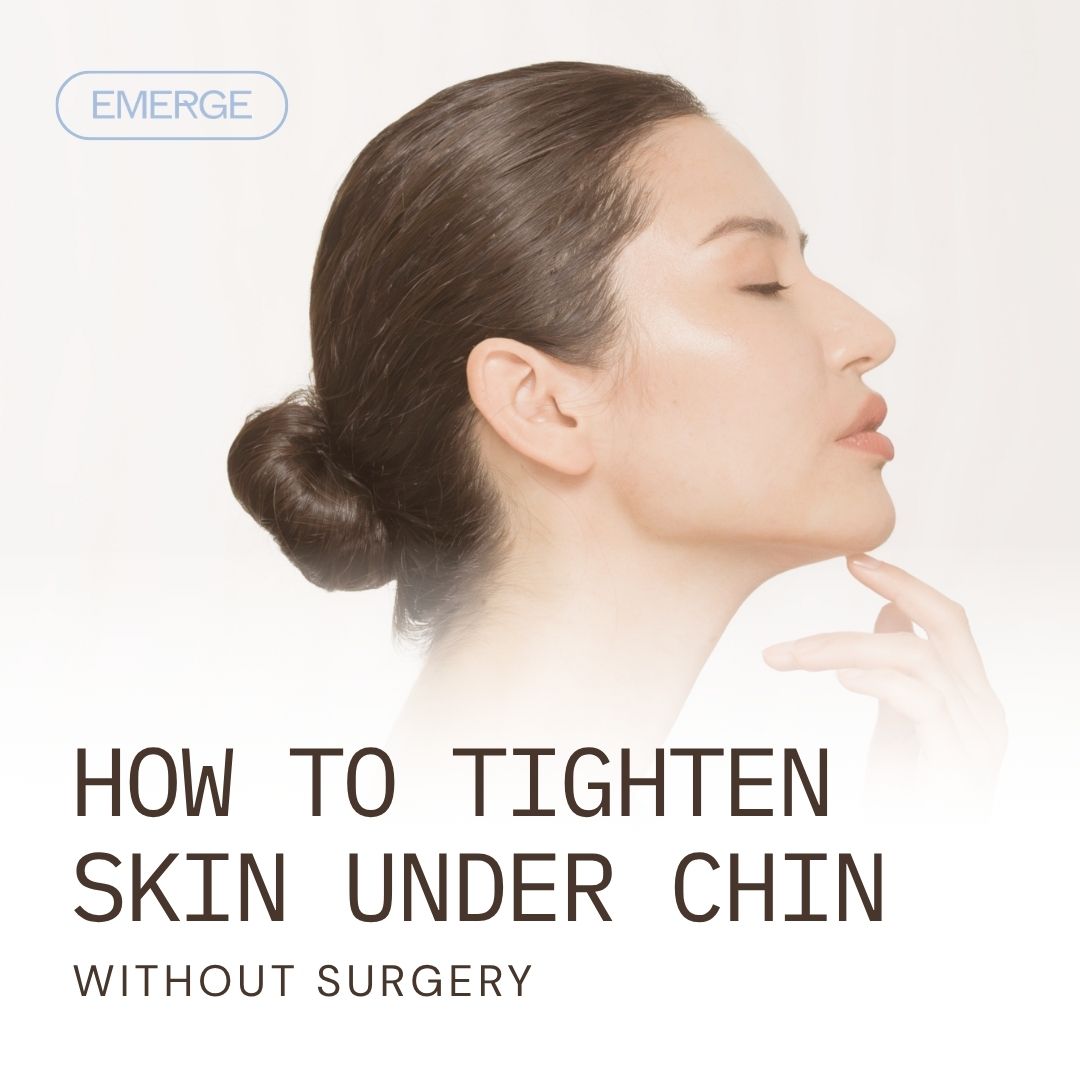 How to Tighten Skin Under Chin​ With Non-Surgical Procedures