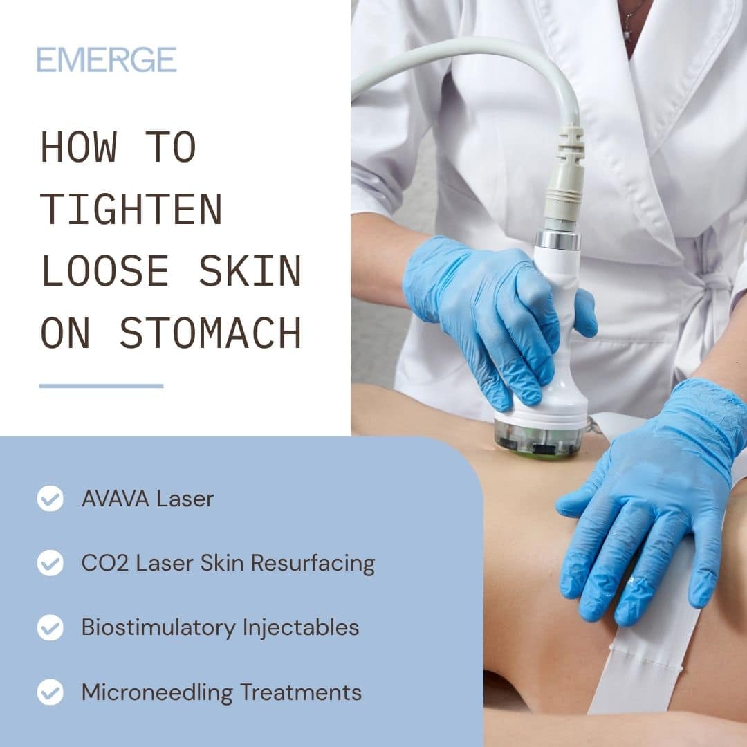 How to Tighten Loose Skin on Stomach