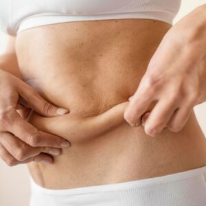 How to Tighten Stomach Skin Without Surgery