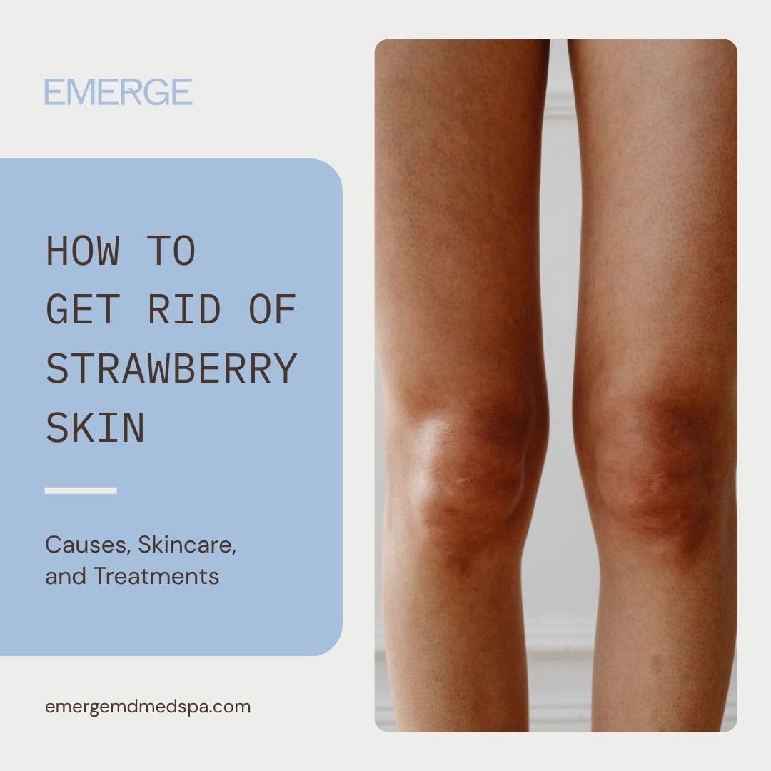 How to Get Rid of Strawberry Skin