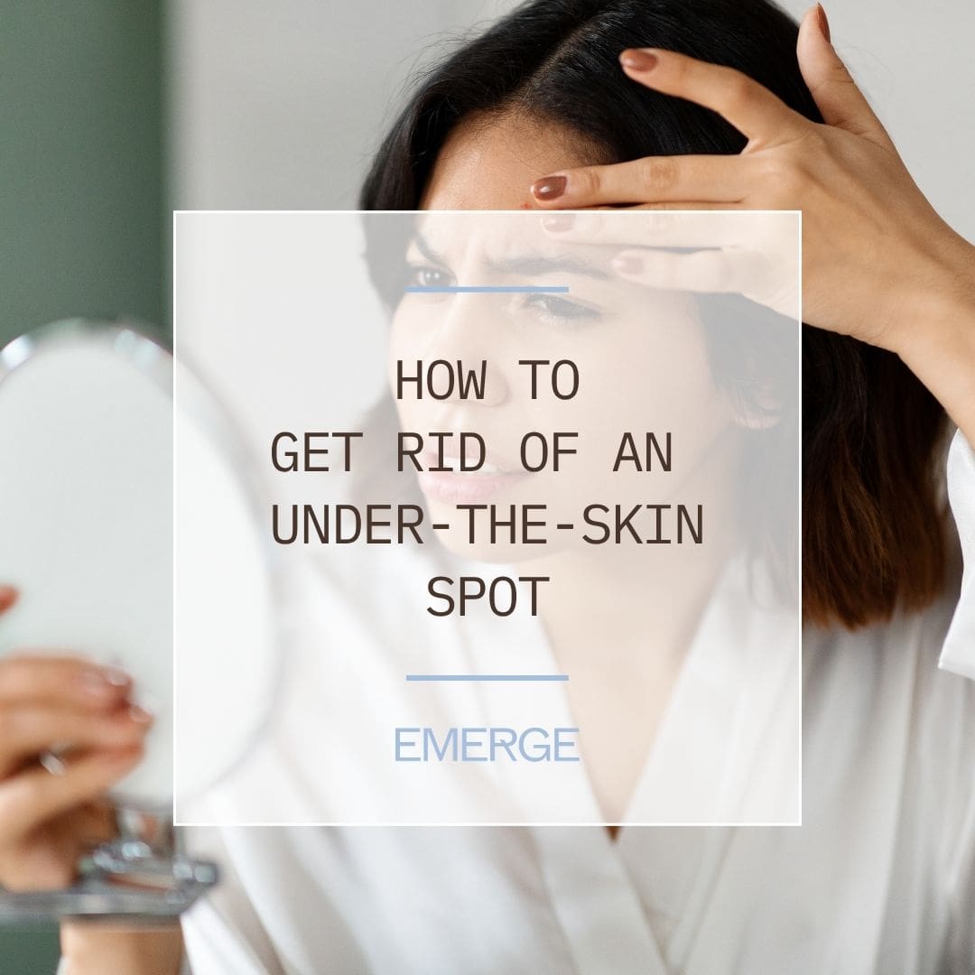 How to Get Rid of an Under-The-Skin Spot | Emerge Aesthetics by Dr. Rochelle Kling MD How to Get Rid of an Under-The-Skin Spot