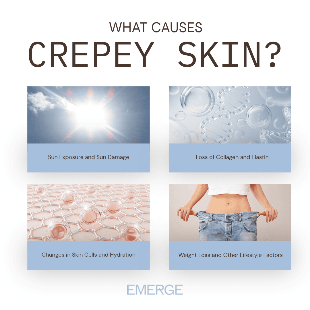 What Causes Crepey Skin?