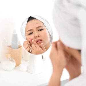 How to Get Rid of an Under-The-Skin Spot