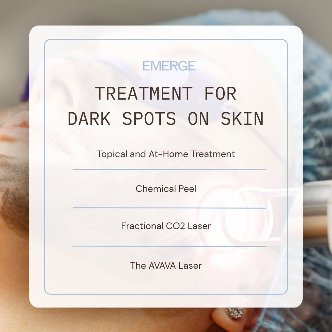 Treatment for Dark Spots on Skin